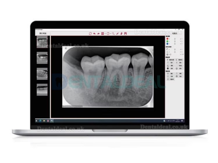 Runyes DS630 PSP Digital Image Phosphor Plate Scanner X-ray PSP Scanner